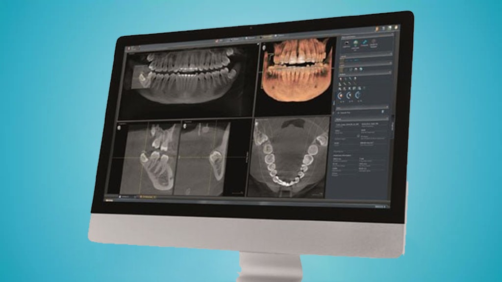 https://nanodental.co.uk/wp-content/uploads/2023/08/Dental-Tomography.jpeg