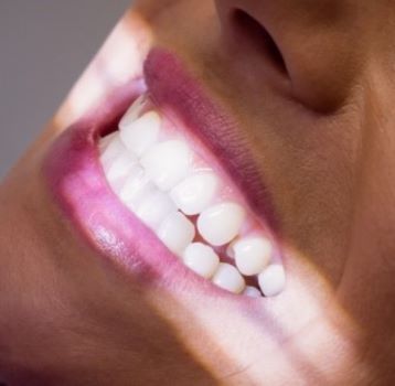 female-patient-receiving-dental-treatment-50023